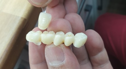 Palatal, lat L light.jpg